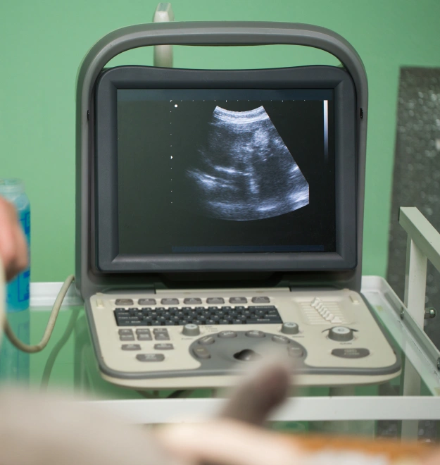 Early Detection of Soft Tissue Issues With Ultrasound